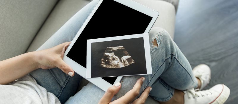 Quante ecografie vanno fatte in gravidanza?